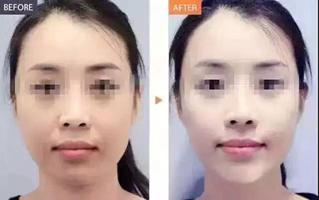 還在靠敷面膜補(bǔ)水？那你的皮膚肯定出問(wèn)題！