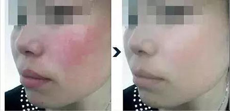 還在靠敷面膜補(bǔ)水？那你的皮膚肯定出問(wèn)題！