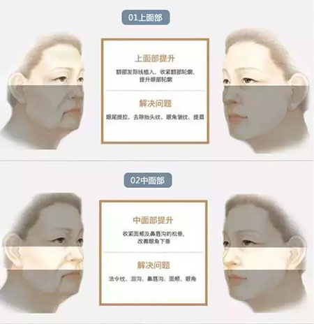 她只是做了個黃金V雕，3年后結果震驚了所有人！