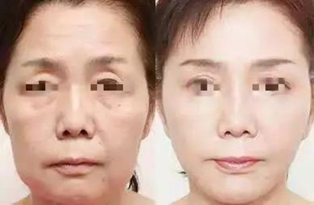 她只是做了個黃金V雕，3年后結果震驚了所有人！