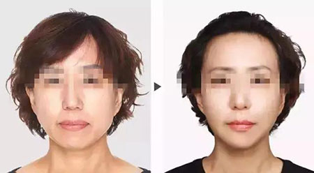 她只是做了個黃金V雕，3年后結果震驚了所有人！