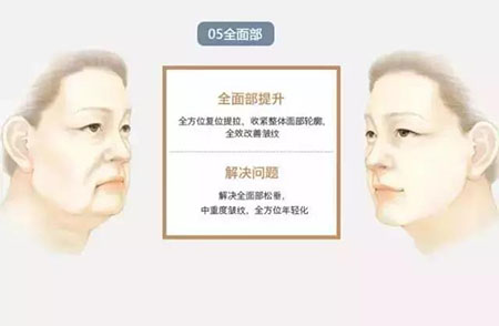 她只是做了個黃金V雕，3年后結果震驚了所有人！
