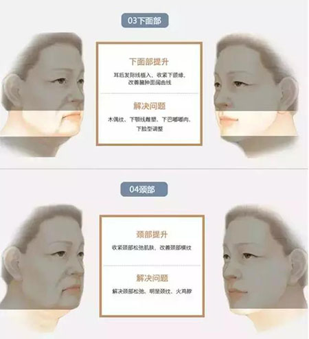 她只是做了個黃金V雕，3年后結果震驚了所有人！