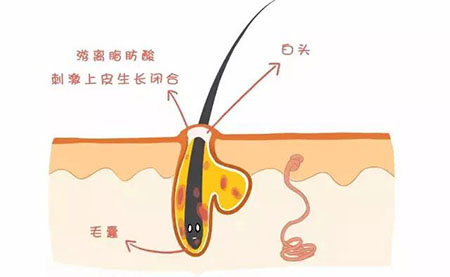 “閉口”這個磨人的小妖精又出來作妖啦！