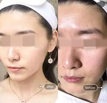 “一洗白”能變白？假的！它才是美白正確的打開方式