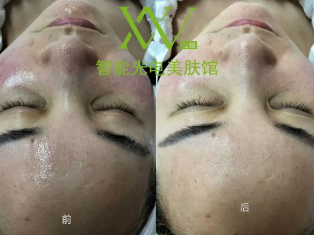 “一洗白”能變白？假的！它才是美白正確的打開方式