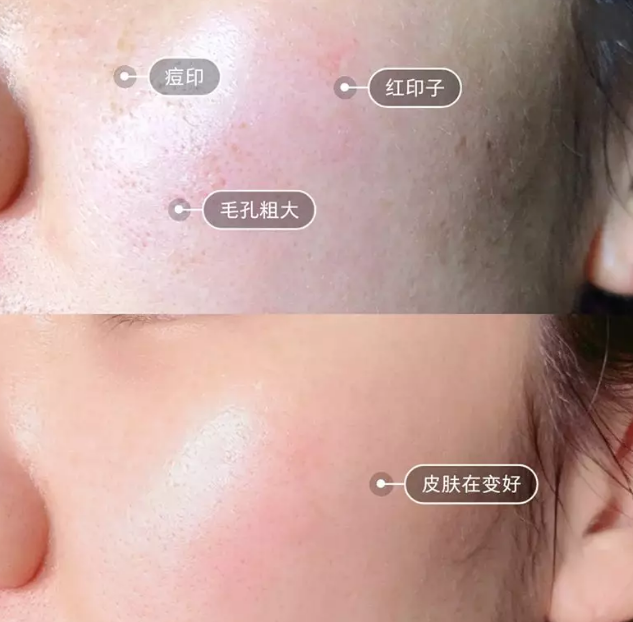 “一洗白”能變白？假的！它才是美白正確的打開方式