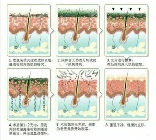 提亮膚色，收毛孔改善皺紋