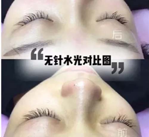 水光嫩膚管理凈化膚色、美白嫩膚