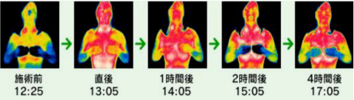 召香美分享：肌肉骨骼疲勞痛癥？80%人都需要“黑科技”疼痛管理